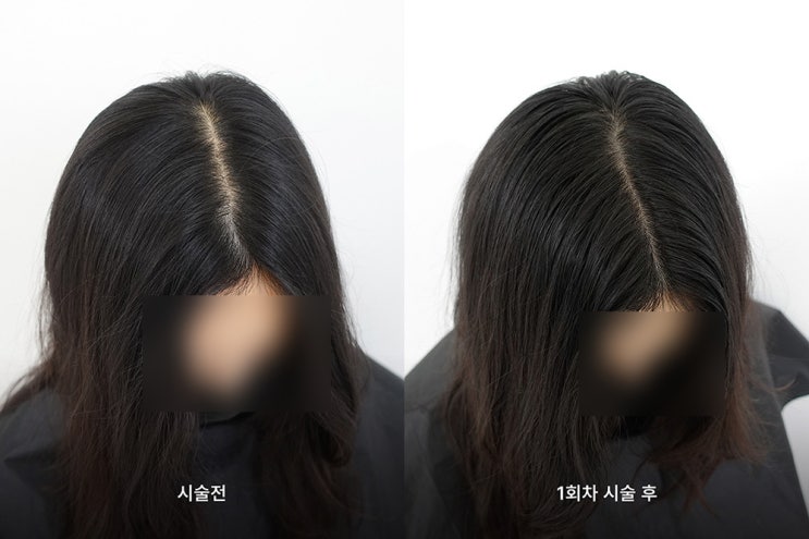 라이모플러스 — [강서] 라이모플러스